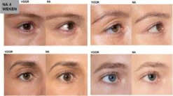 L'Oréal Paris Clinically Proven Wimperserum - 2 Ml -Mode-Cosmetica Winkel 1200x670